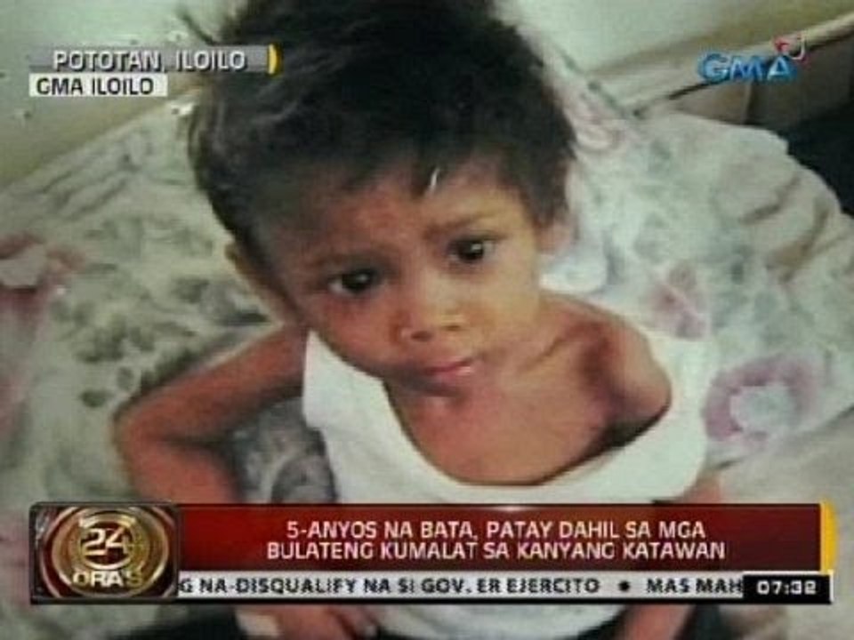 24 Oras: 5-anyos na bata, patay dahil sa mga bulateng kumalat sa kanyang katawan