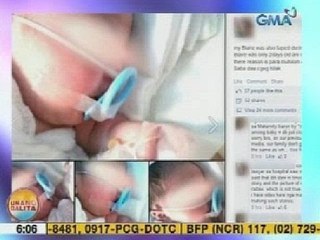 UB: DOH: Pagte-tape ng pacifier sa bibig ng 2 sanggol, hindi katanggap-tanggap