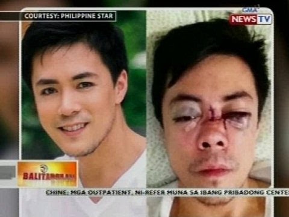 BT: Birthday at thanksgiving dinner, idinaos kasunod ng matagumpay na operasyon ni Lance Raymundo