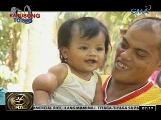 24 Oras: Sanggol na may bukol sa kanang braso, kailangang maoperahan