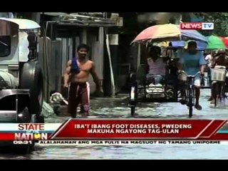 SONA: Iba't-ibang foot disease, pwedeng makuha ngayong tag-ulan