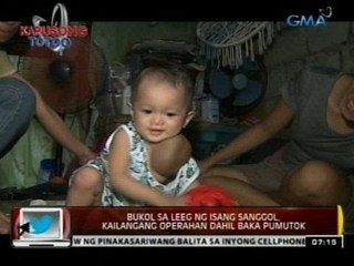 24Oras: Bukol sa leeg ng isang sanggol, kailangang operahan dahil baka pumutok