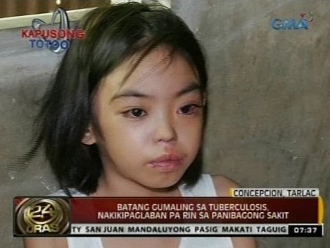 24 Oras: Batang gumaling sa tuberculosis, nakikipaglaban pa rin sa panibagong sakit