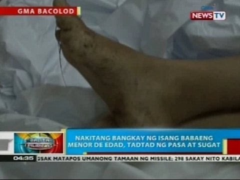 Nakitang bangkay ng isang babaeng menor de edad, tadtad ng pasa at sugat