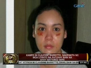 Claudine Barretto, nagka-pasa raw dahil sa post-surgical procedure, ayon kina Raymart Santiago