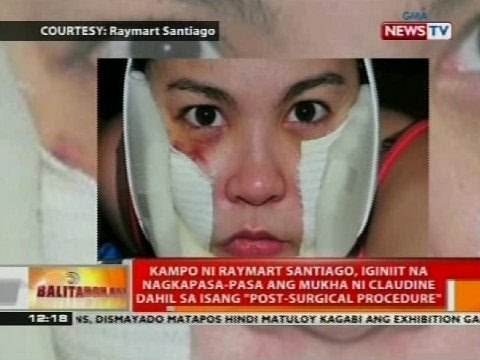 Claudine, nagka-pasa dahil daw sa post-surgical procedure, ayon sa kampo ni Raymart