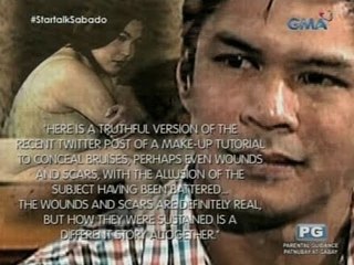 Startalk: Ang buwelta ni Raymart Santiago sa estranged wife na si Claudine Barretto