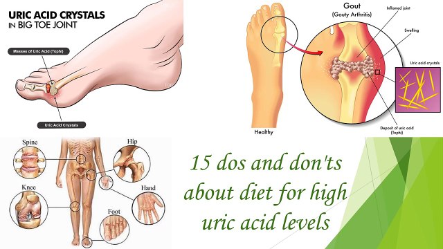 Uric Acid Crystals(Arthritis / Pain) - Dos and Donts