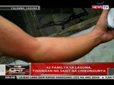 QRT: 42 pamilya sa Laguna, tinamaan ng sakit na chikungunya