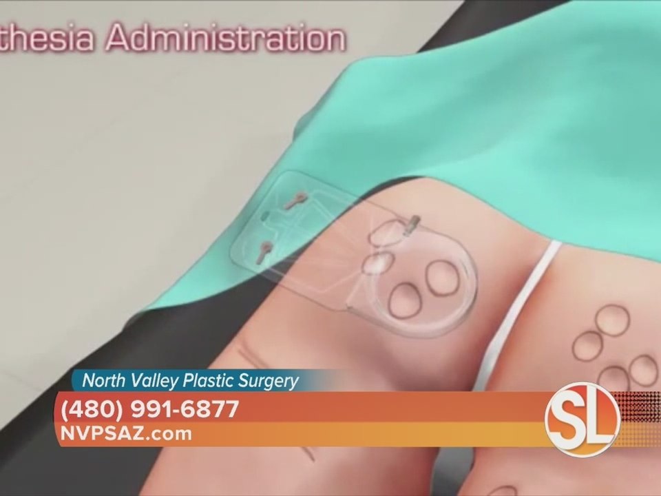 North Valley Plastic Surgery offers non-surgical options including Cellfina