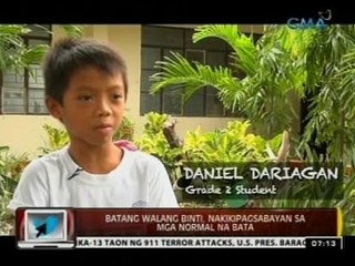 24Oras: Batang walang binti, nakikipagsabayan sa mga normal na bata