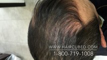 Thinning hair solution for Men & Women ,Hair Cubed Hair fibers