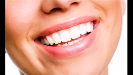 DOGAL VE BASİT DİŞ BEYAZLATMA İZLEYELİM.