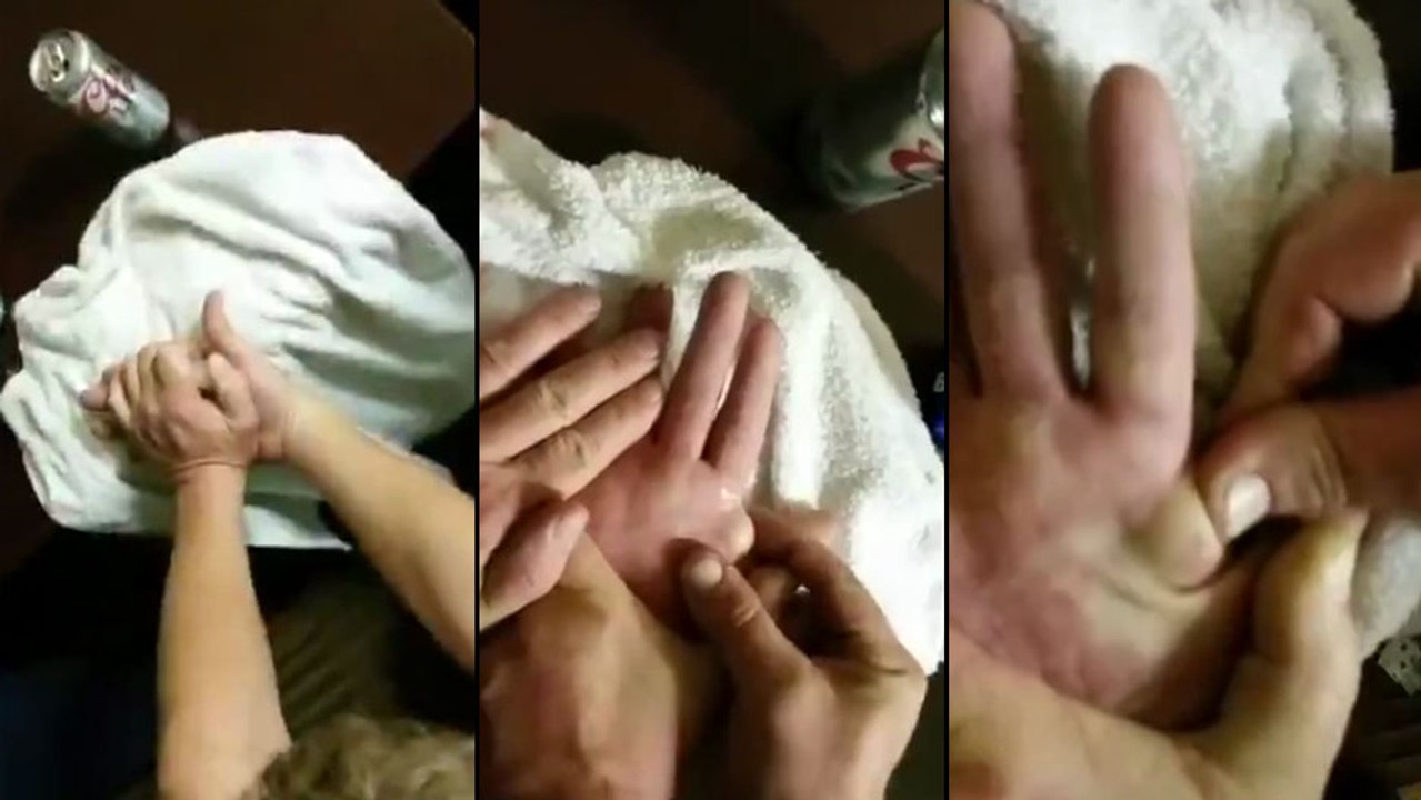 Ce mec se fait percer une grosse boule sur sa main