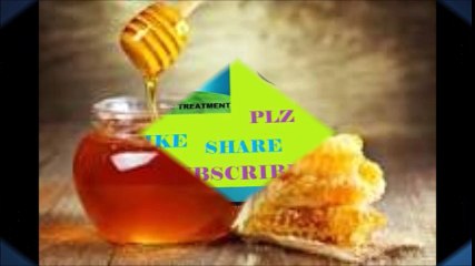 Honey can be harmful to   हनी कैसे हानिकारक हो सकता है?