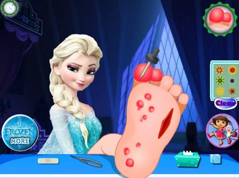 Анна поранила ногу и мы ее лечим! Игра для девочек! Развивающие игры для детей!