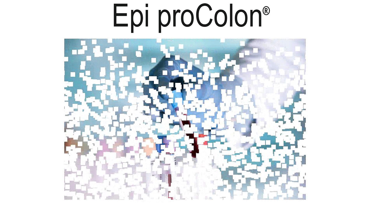 Epi proColon - Know the Features