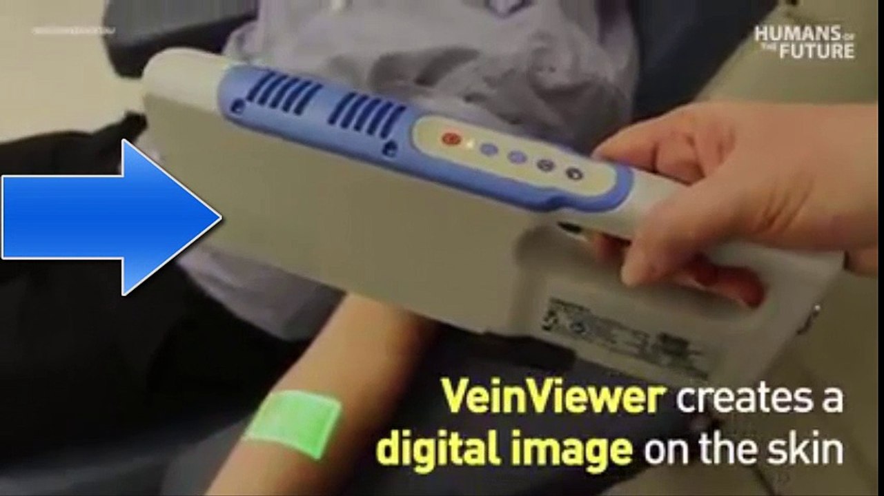 Smart Vein Finder