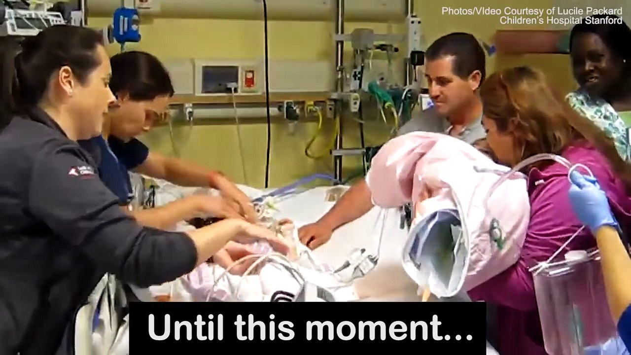 The moment conjoined twins see each other after separation-ooR_LBC4Waw
