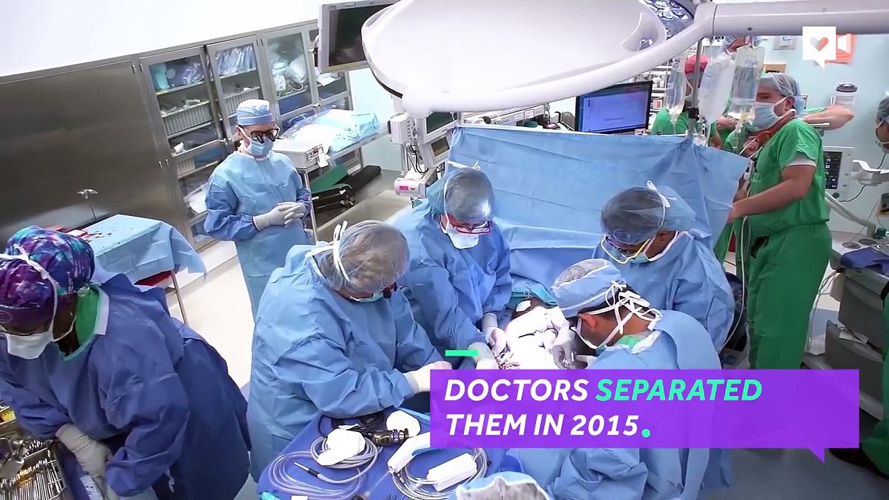 Previously conjoined sisters are now able to walk-DYhQ-dOYGdk