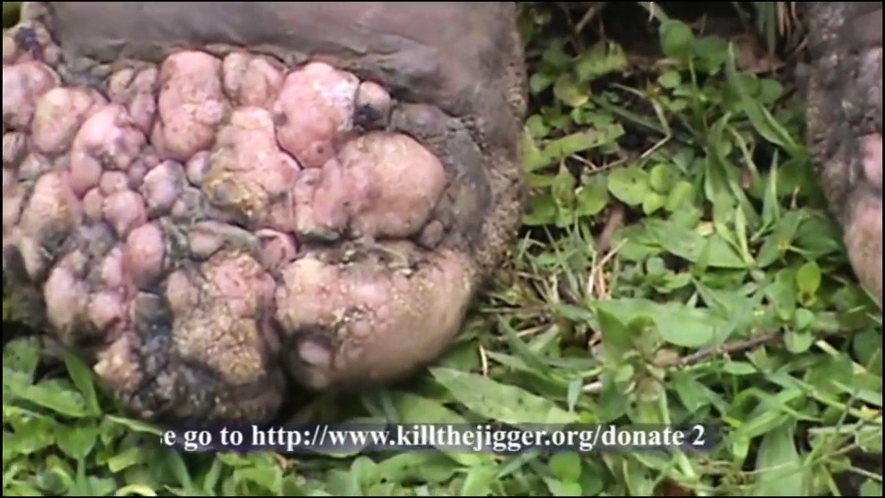 Top 10 Grossest Things Found Inside Of People