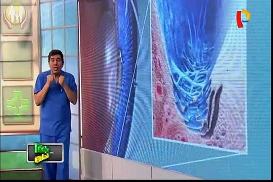 Doctor en Familia: ¿Qué es una hernia? síntomas, diagnóstico y tratamiento