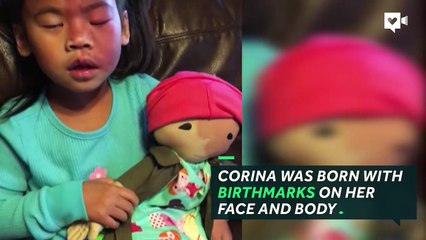 Little girl with birthmarks is given a special gift to boost her confidence-jbqtdwni38k