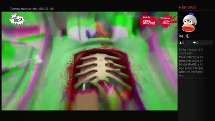 Transmisión de PS4 en vivo de SURGEON SIMULATOR