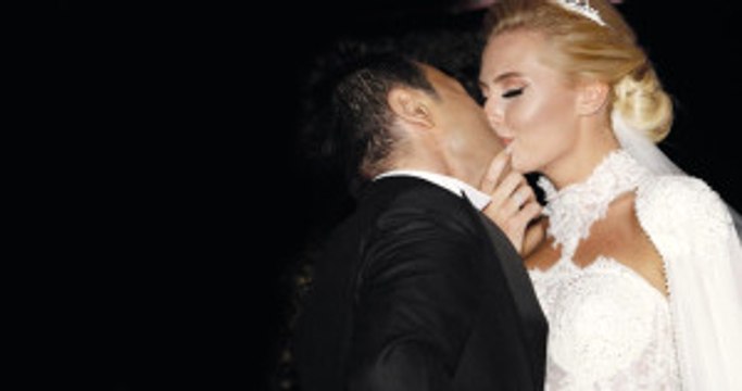 Serdar Ortaç'ın Eşi Chloe Loughnan Silikon Taktırdı