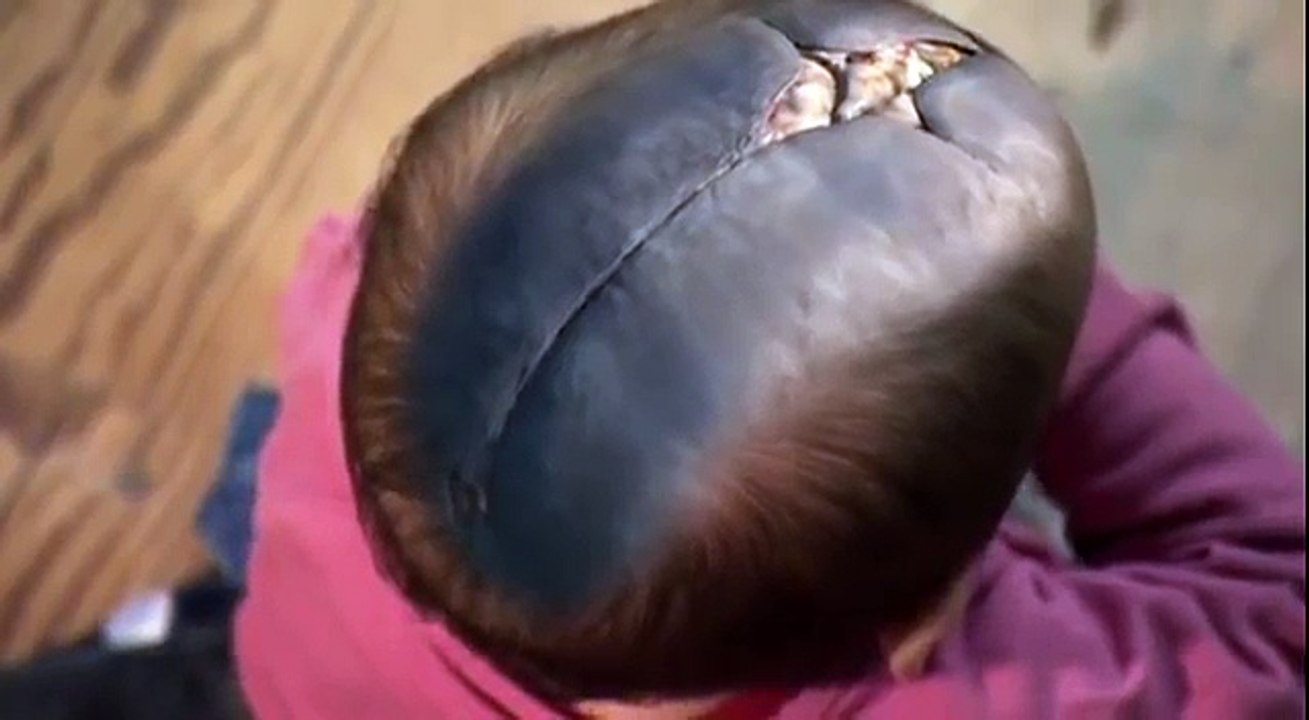 Inside the living body