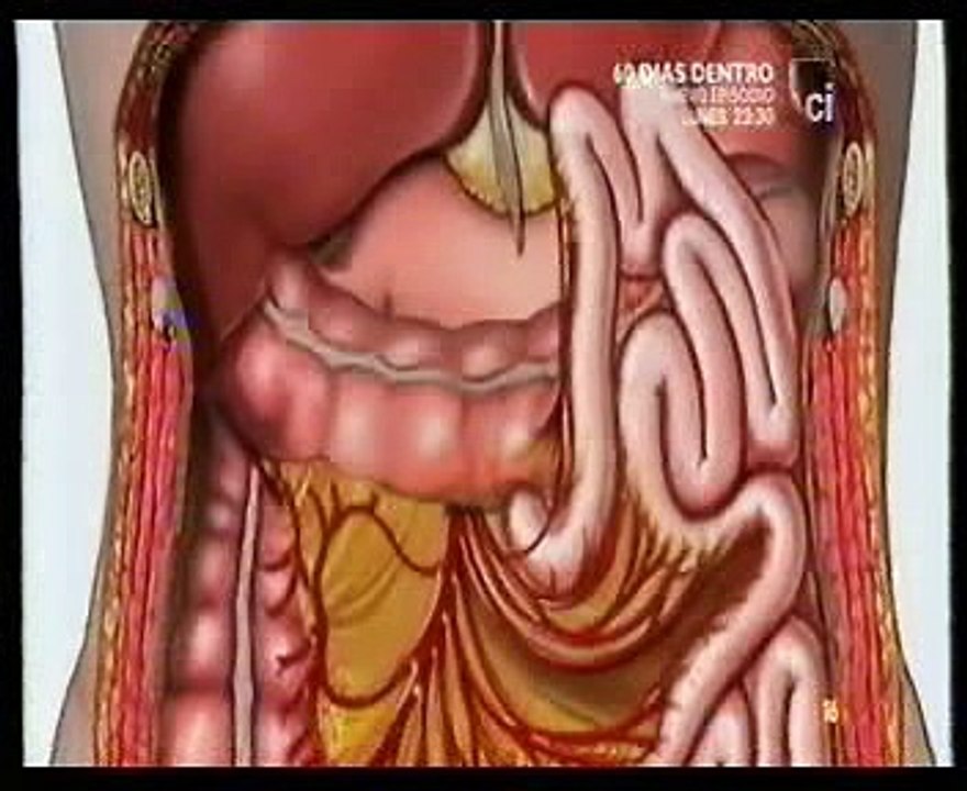 Enterolito: Autopsia forense