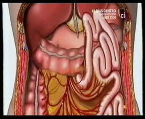 Enterolito: Autopsia forense