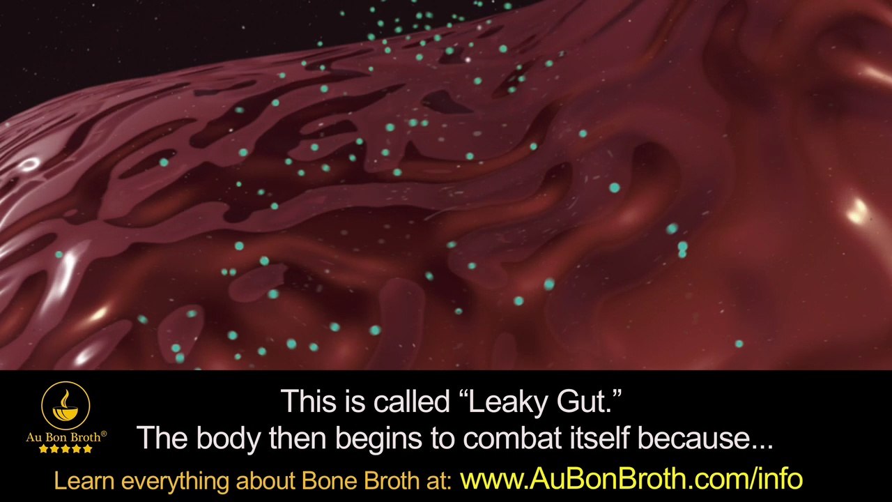 Your Health IS Your Gut! Doctors Now Know Without Question the Health of your Gut is Everything!