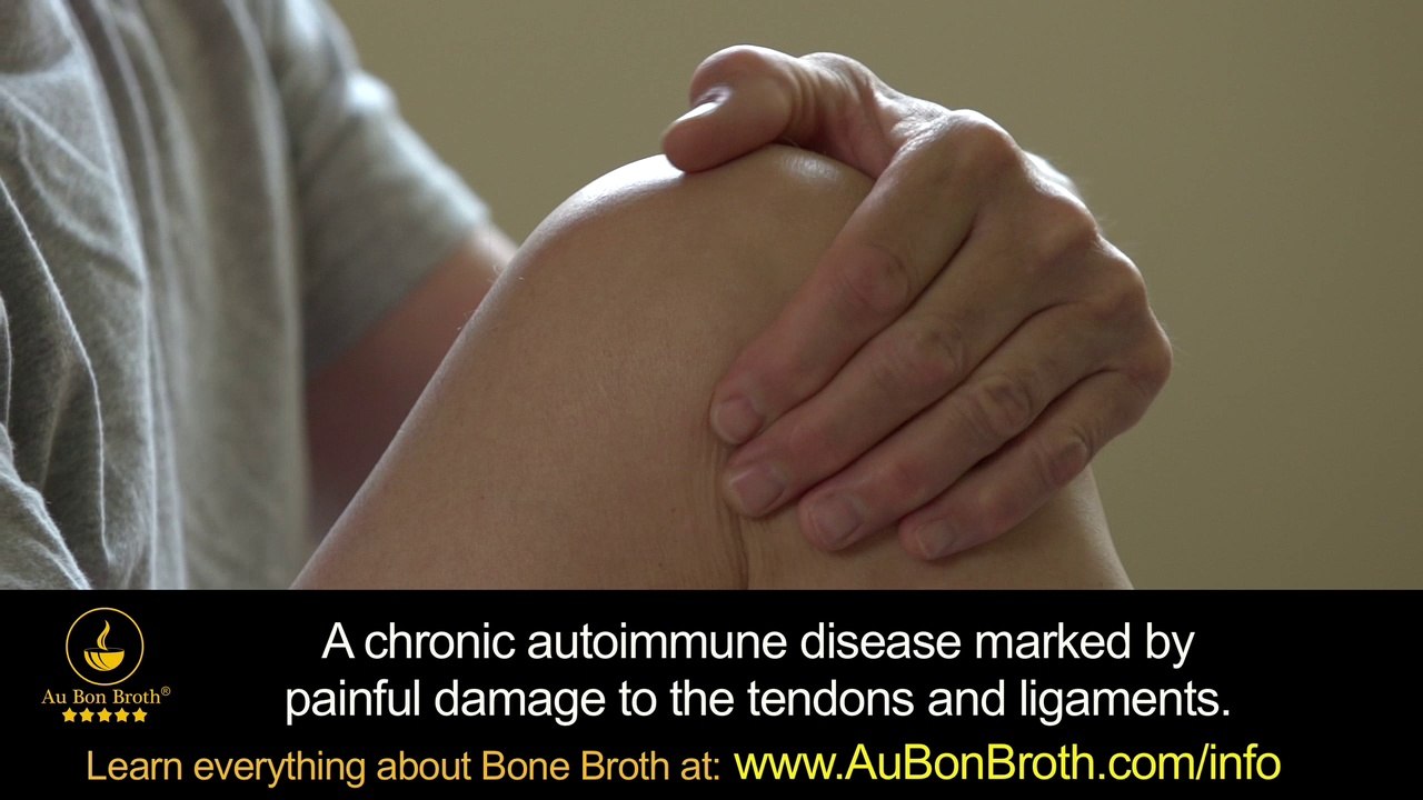 Aches & Pains? Overall Stiffness? If You Have Joint Pain or Problems You Have Got To TRY THIS!