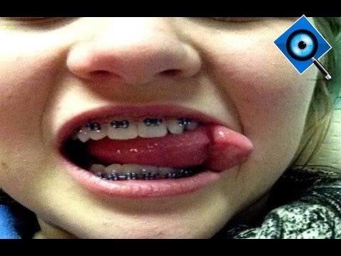 10 Coisas Que voce Não Sabia Sobre o Corpo Humano - Os Curiosos