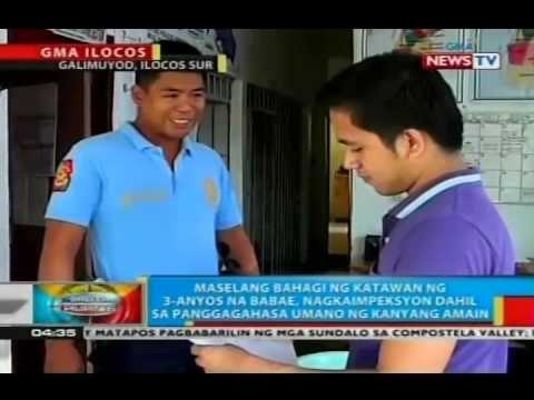 Maselang bahagi ng katawan ng 3-anyos na babae, nagkaimpeksyon dahil umano sa panggagahasa