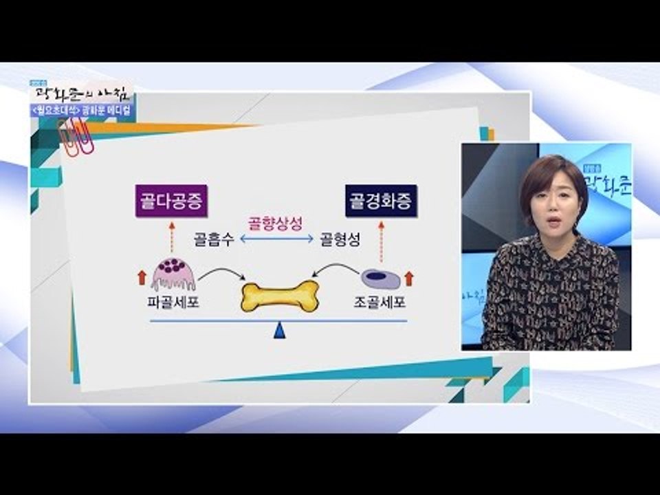 사골 국물, 골다공증 예방하다! [광화문의 아침] 377회 20161212