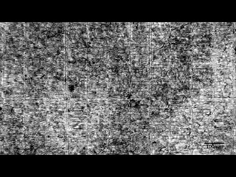 Parche impreso en 3D para corazones dañados