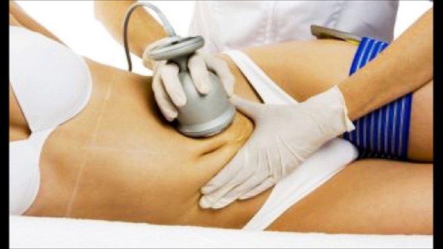 Dr David Evdokimow Explains Fat Reduction Procedures Ultrasound Vs Laser