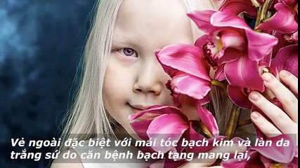 Cận cảnh nét hồn nhiên của “Bạch tuyết xứ Siberia”