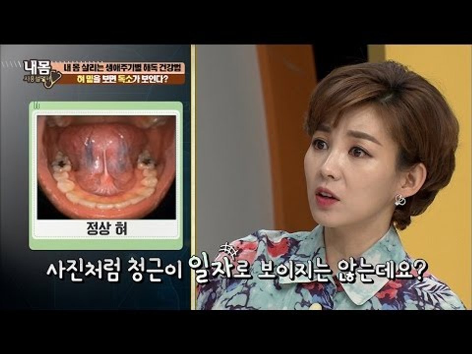 혀 밑을 보면 나의 혈액 오염 정도를 알 수 있다! [내 몸 사용설명서] 131회 2...
