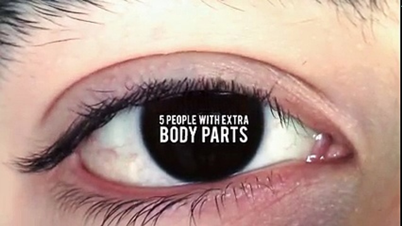 5 People With Extra Parts