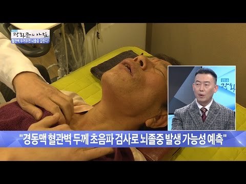 미니 뇌졸중, 이런 증세 있으면 의심! [광화문의 아침] 366회 201611125