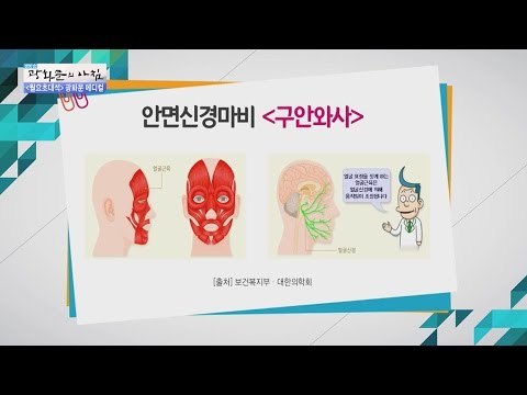 안면신경마비란? [광화문의 아침] 362회 20161121