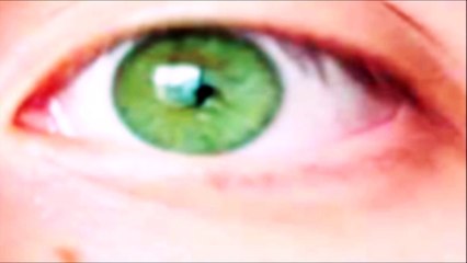 BIOKINESIS OLHOS VERDES ULTRA AVANCADA RESULTADOS EM 3 SEMANAS