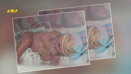 ALIEN BABY Found In India | Weird Asia