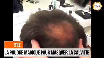 Grâce à Densitée, plus personne ne verra le dessus de votre crâne !