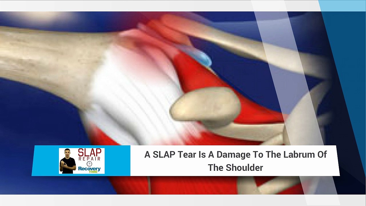 Slap Tear Surgery