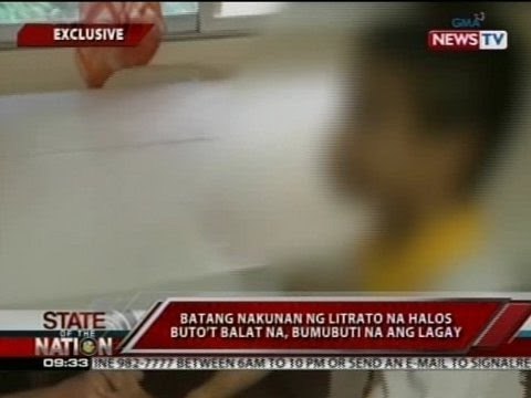 SONA: Batang nakunan ng litrato na halos buto't balat na, bumubuti na ang lagay