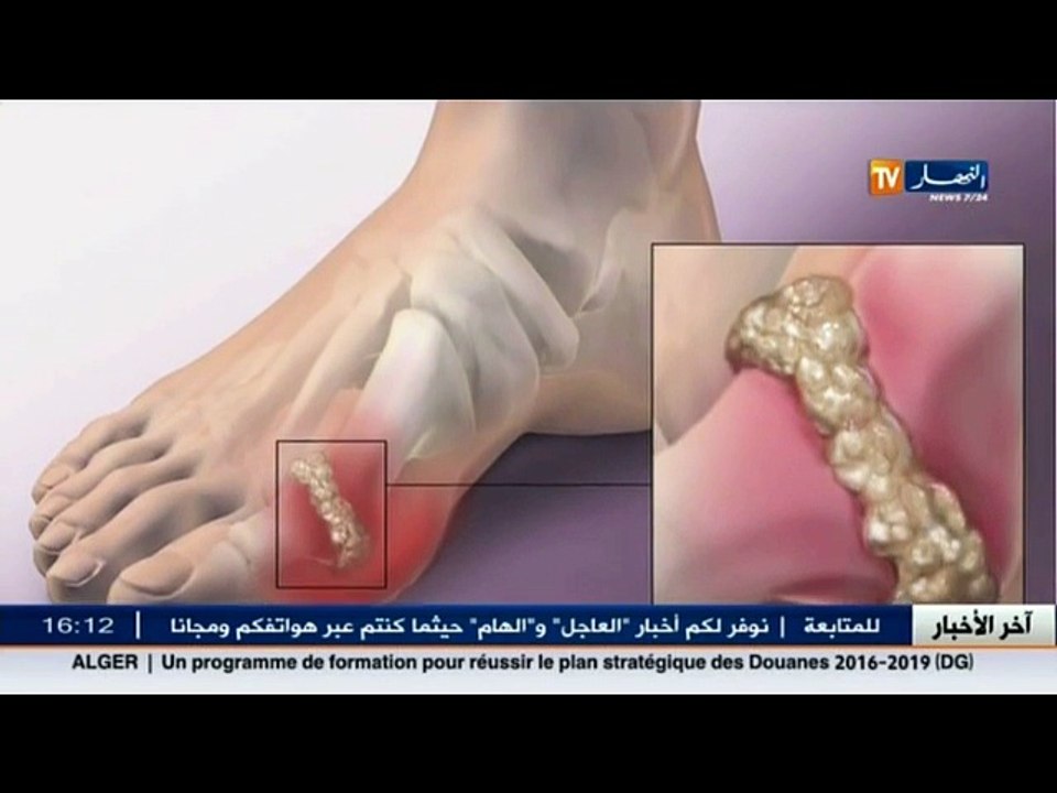3 دقائق صحة   هذا ما قد يسببه أكل اللحوم و البر...